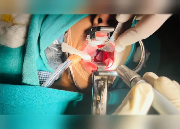Tonsillectomy